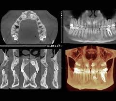 Planmeca ProMax 3D Imagery
